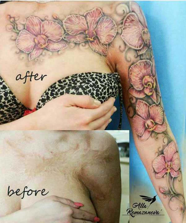 A tattoo that hides a scar