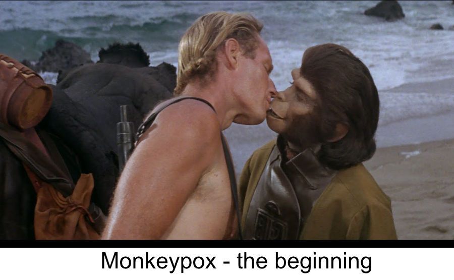 Monkeypox - the beginning 
