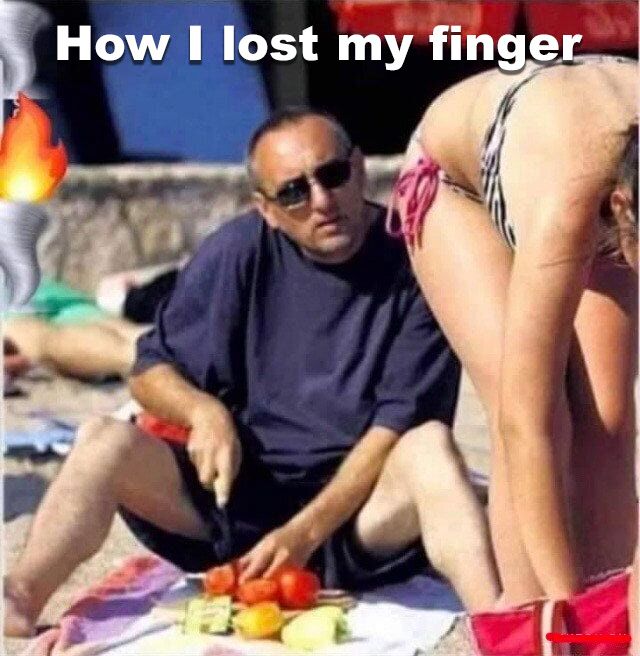 How I lost my finger